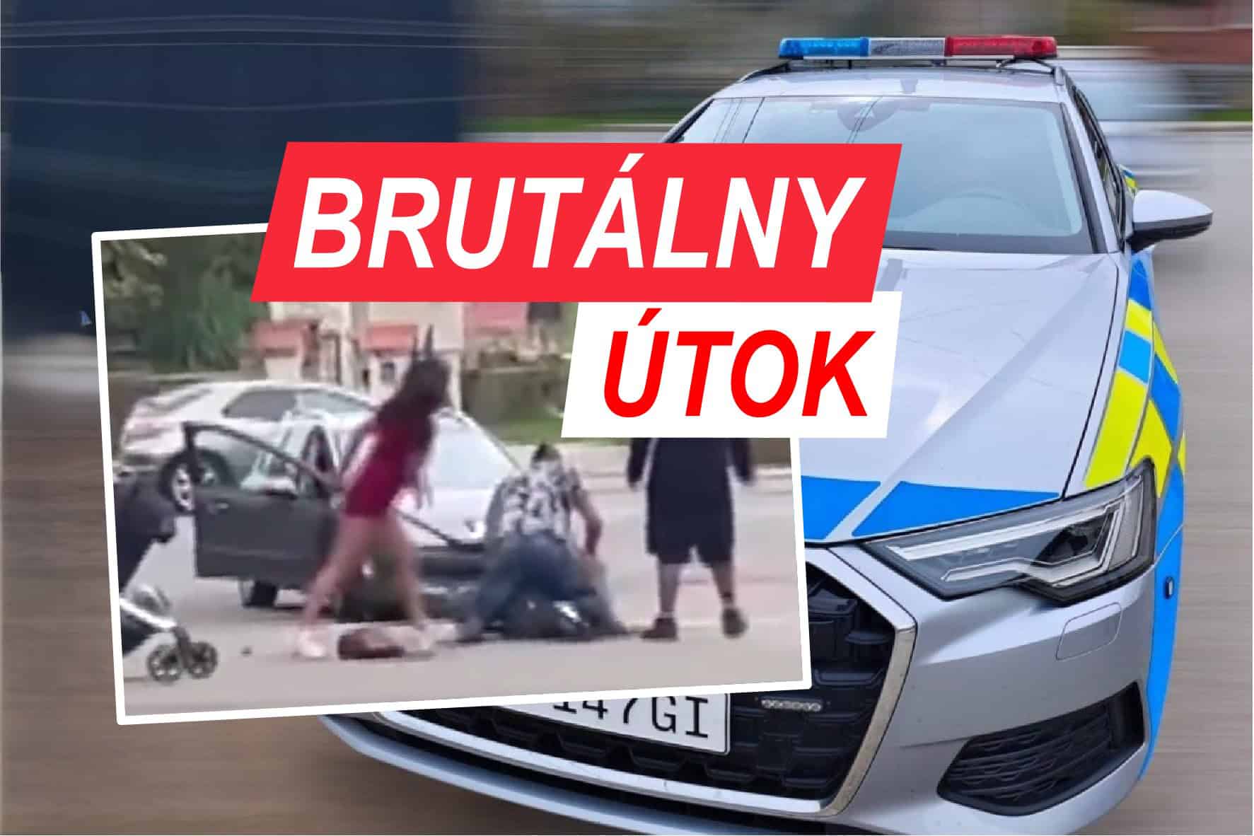 BRUTÁLNY ÚTOK na ulici: Žena (29) kopala do hlavy invalidnému dôchodcovi!