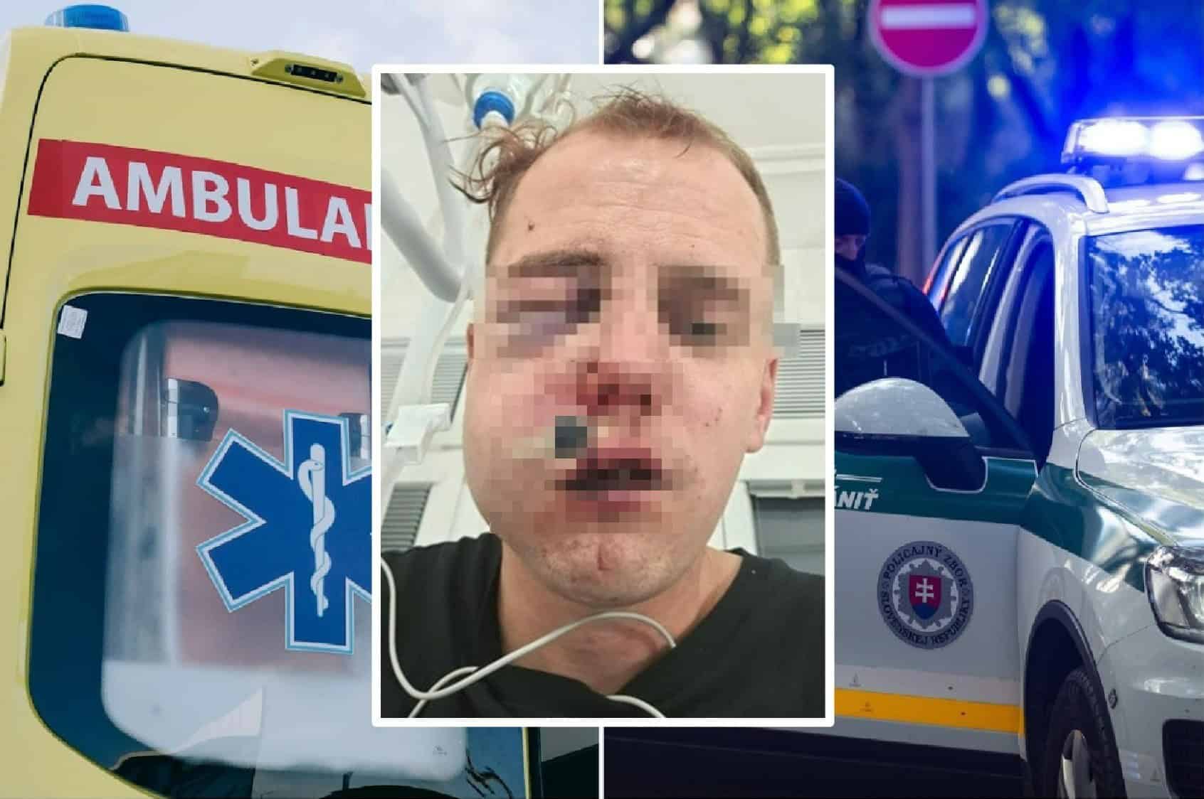BRUTÁLNY ÚTOK v meste: Milan bránil kamaráta, dolámali mu kosti. Musia ho operovať. Mrazivé SVEDECTVO