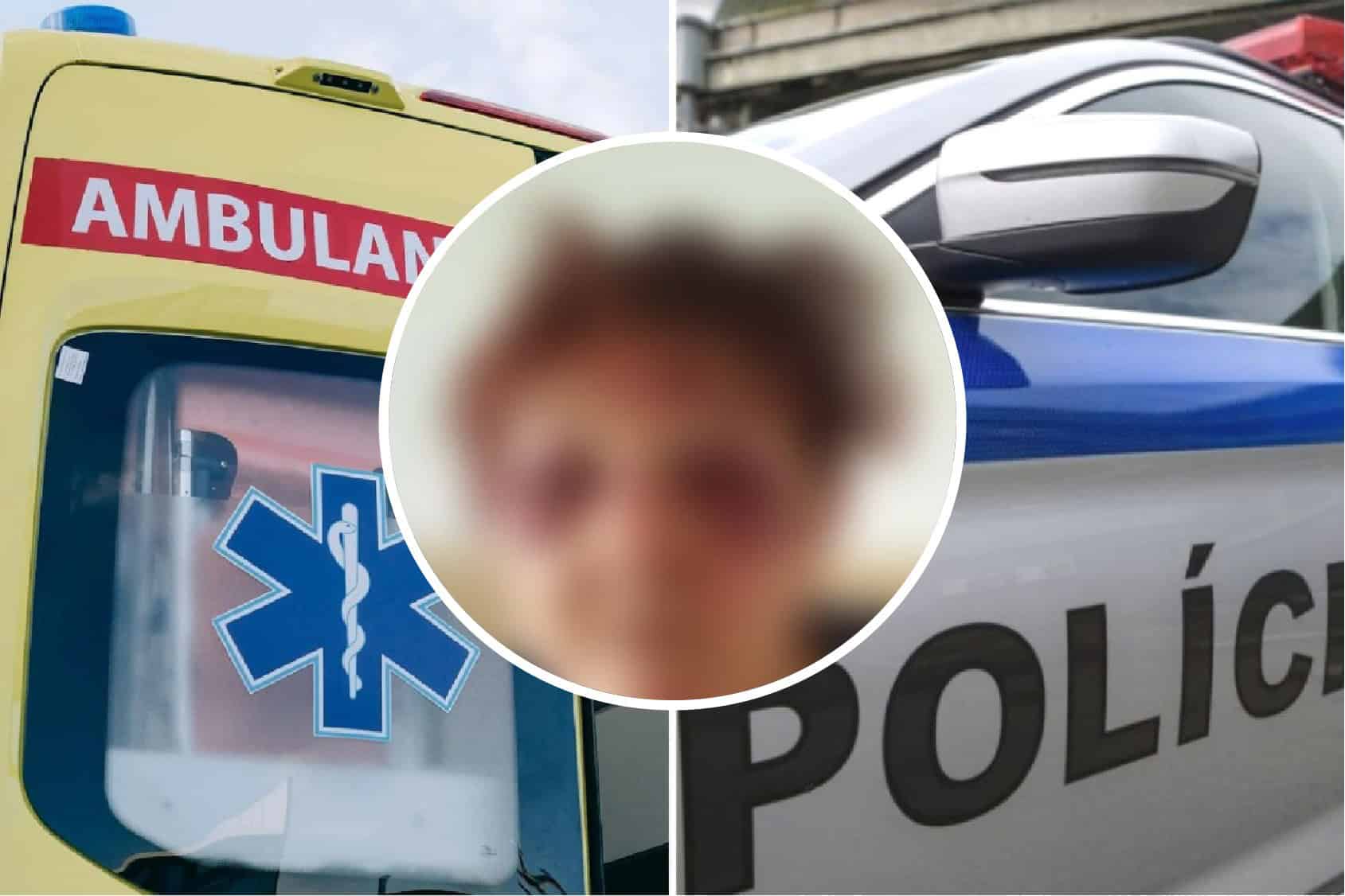 Ženu našli na zastávke celú doráňanú: Pád alebo surový útok mužov? Polícia začala konať